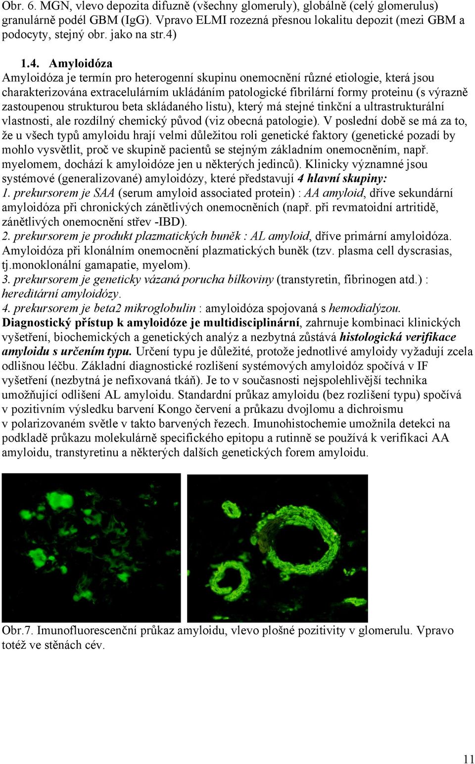 1.4. Amyloidóza Amyloidóza je termín pro heterogenní skupinu onemocnění různé etiologie, která jsou charakterizována extracelulárním ukládáním patologické fibrilární formy proteinu (s výrazně