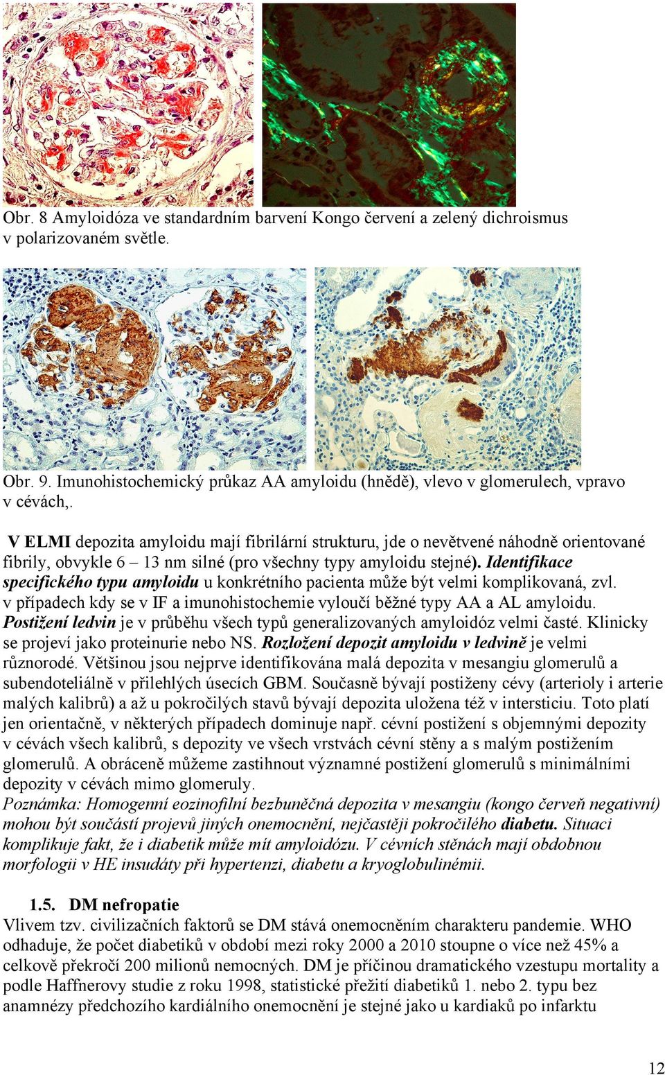 Identifikace specifického typu amyloidu u konkrétního pacienta může být velmi komplikovaná, zvl. v případech kdy se v IF a imunohistochemie vyloučí běžné typy AA a AL amyloidu.