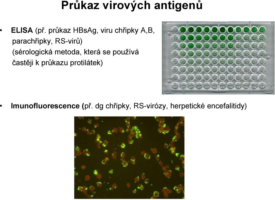 (sérologická metoda, která se používá častěji k průkazu