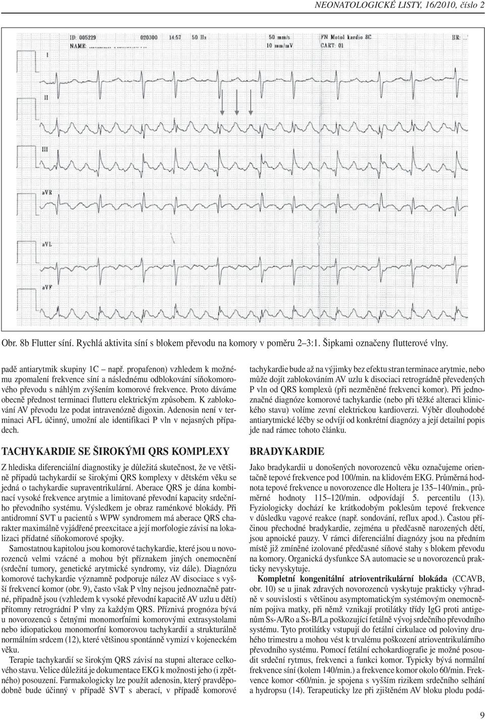 Proto dáváme obecně přednost terminaci flutteru elektrickým způsobem. K zablokování AV převodu lze podat intravenózně digoxin.