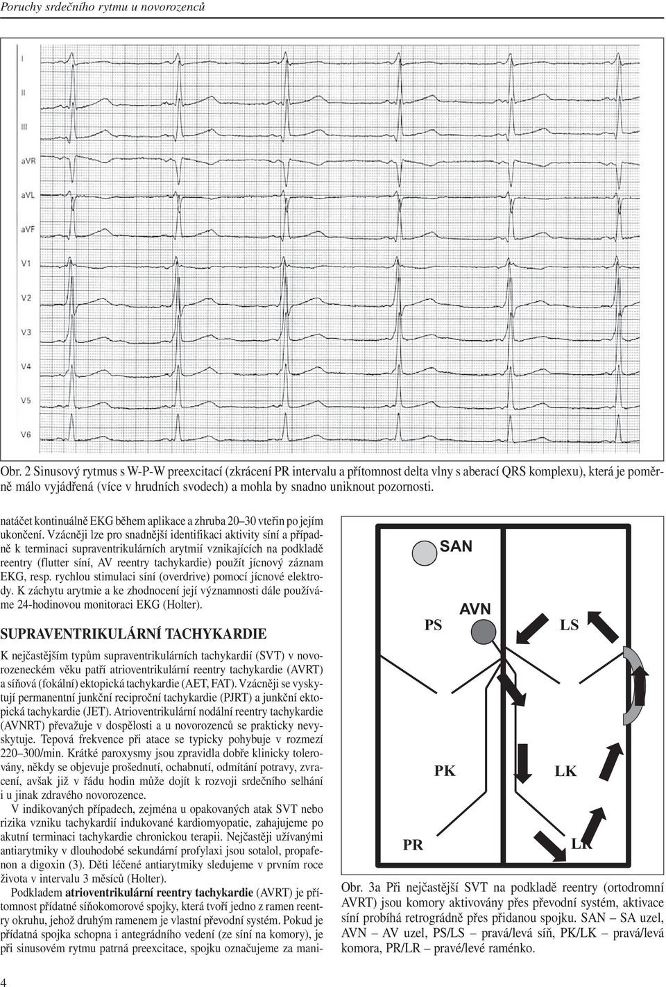 pozornosti. natáčet kontinuálně EKG během aplikace a zhruba 20 30 vteřin po jejím ukončení.