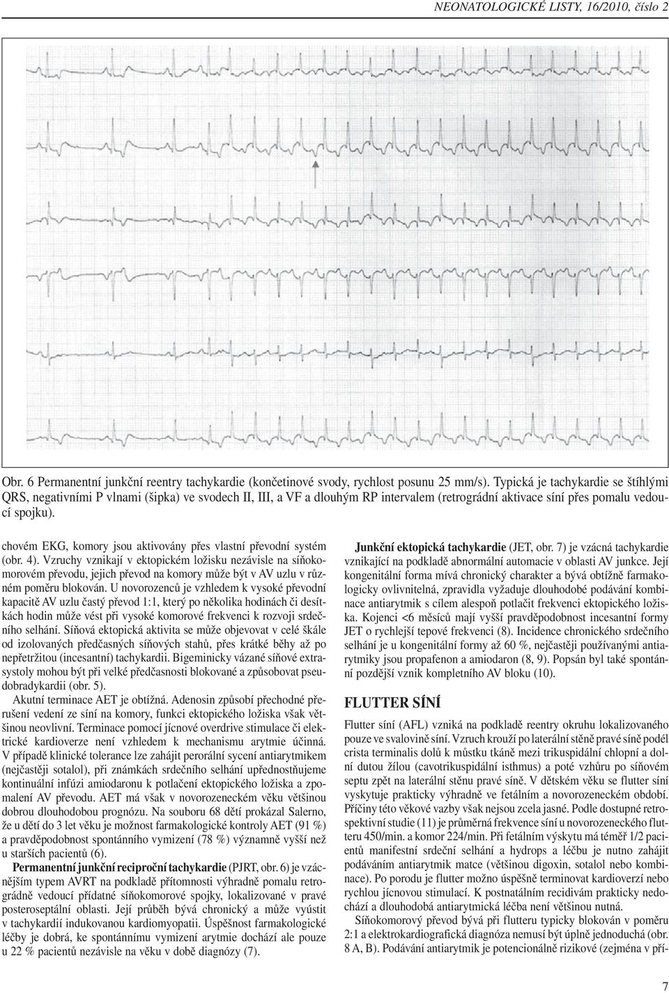 chovém EKG, komory jsou aktivovány přes vlastní převodní systém (obr. 4).