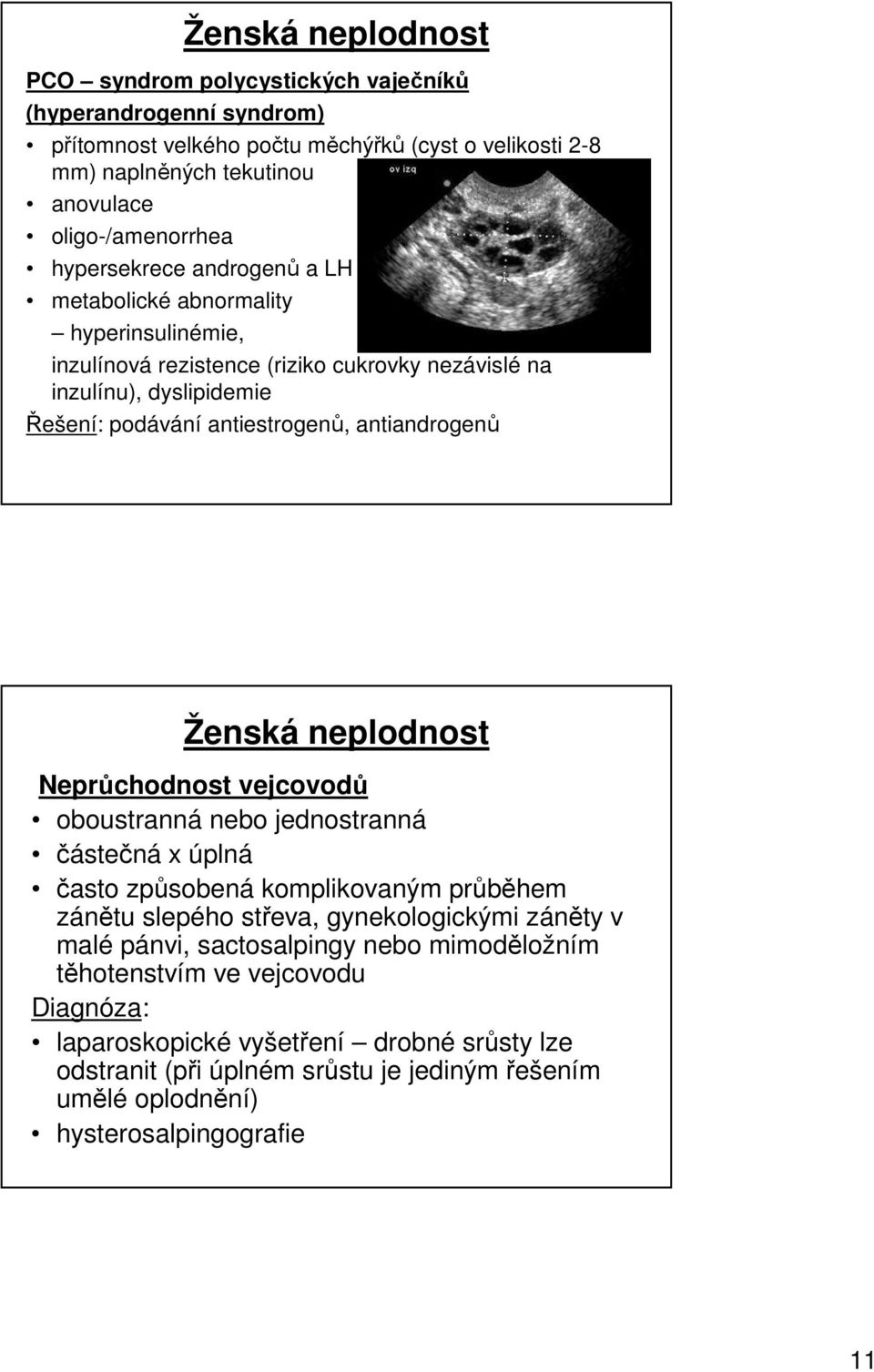 Ženská neplodnost Neprůchodnost vejcovodů oboustranná nebo jednostranná částečná x úplná často způsobená komplikovaným průběhem zánětu slepého střeva, gynekologickými záněty v malé pánvi,