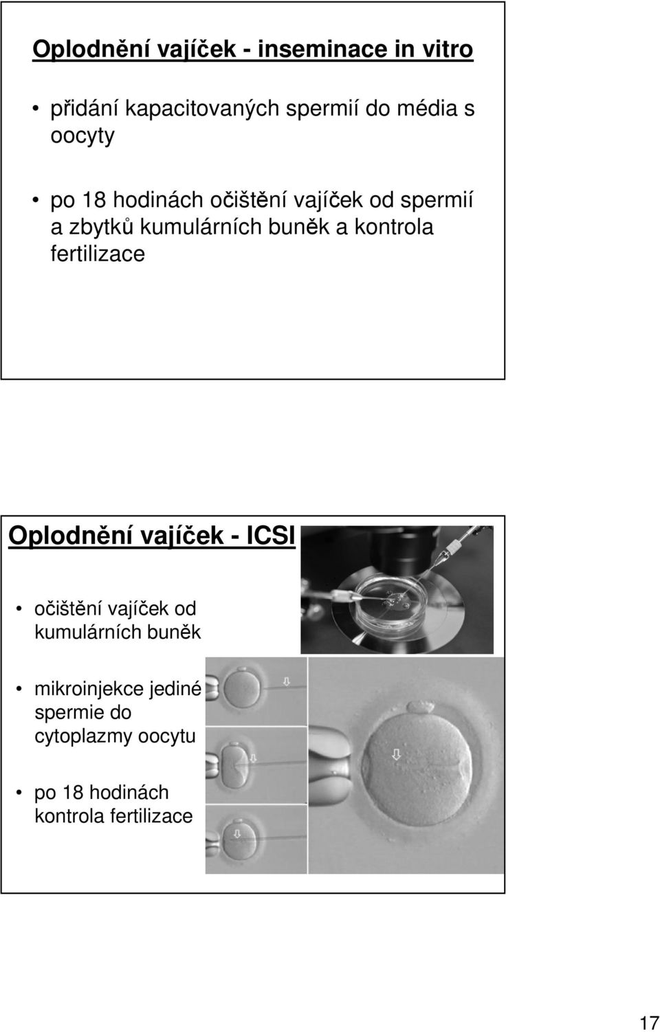 kontrola fertilizace Oplodnění vajíček - ICSI očištění vajíček od kumulárních