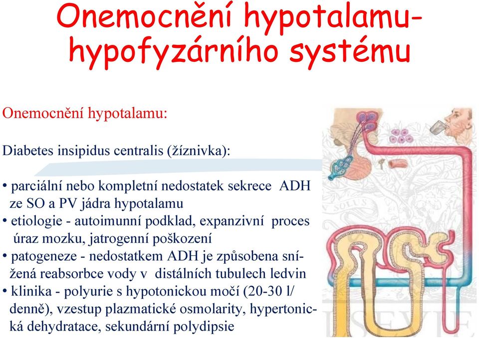 jatrogenní poškození patogeneze - nedostatkem ADH je způsobena snížená reabsorbce vody v distálních tubulech ledvin klinika