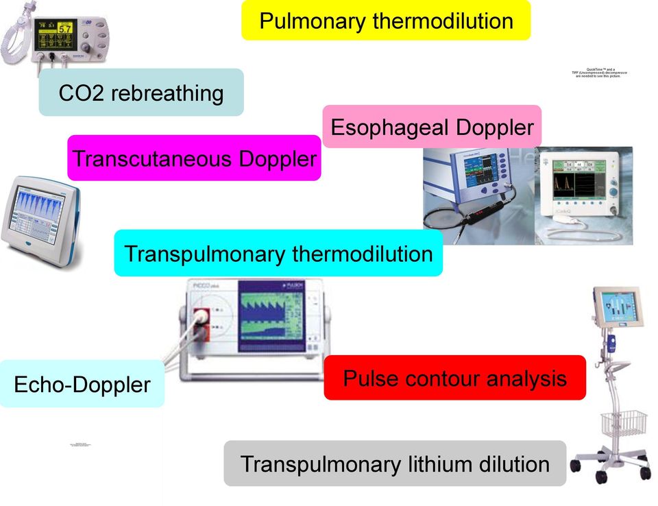 Transpulmonary thermodilution Echo-Doppler Pulse contour analysis Transpulmonary