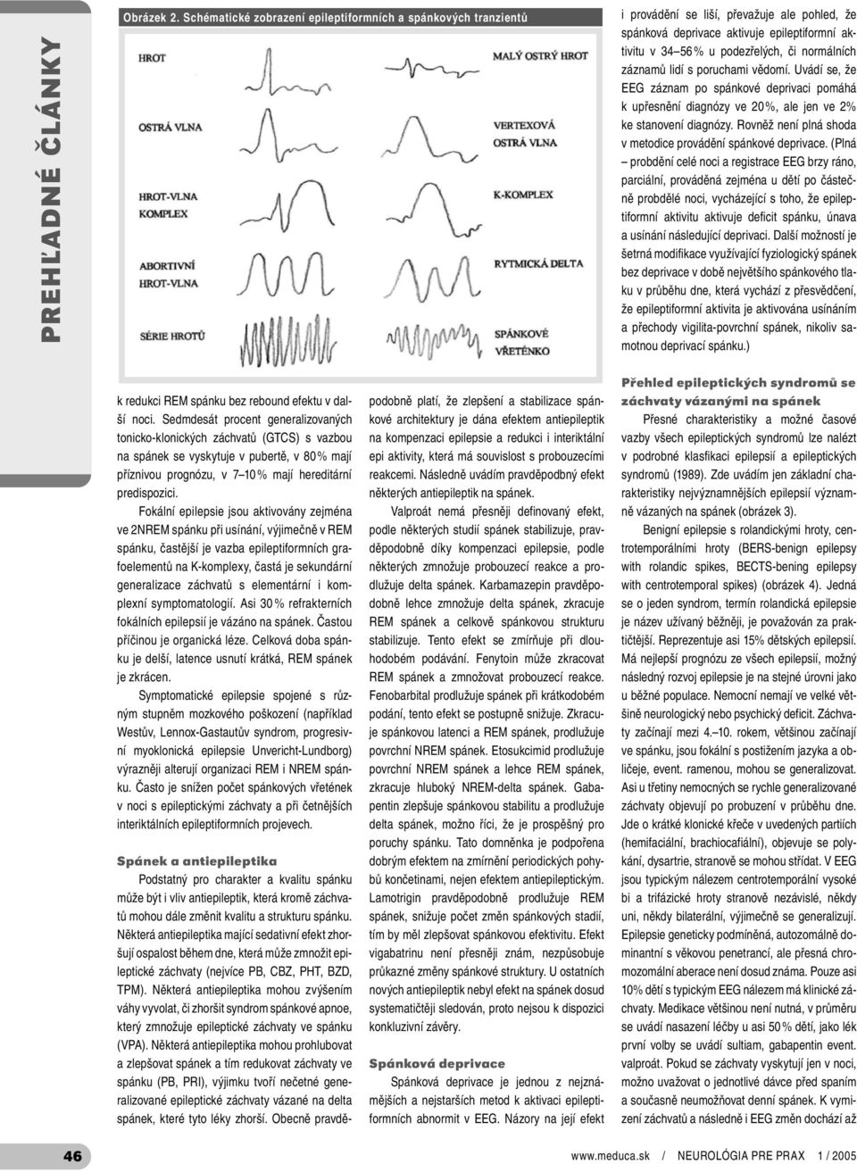 záznamů lidí s poruchami vědomí. Uvádí se, že EEG záznam po spánkové deprivaci pomáhá k upřesnění diagnózy ve 20 %, ale jen ve 2% ke stanovení diagnózy.