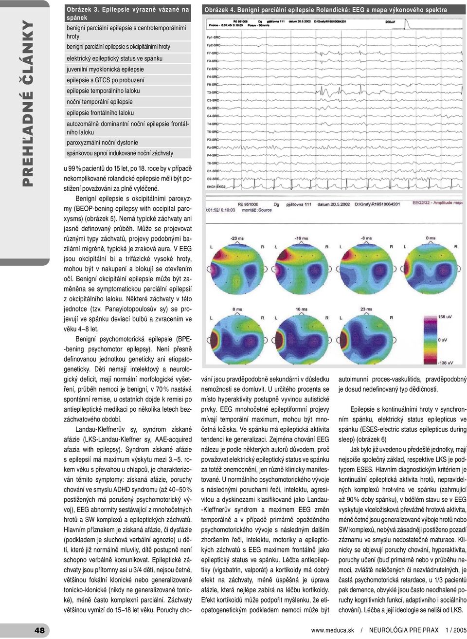 myoklonická epilepsie epilepsie s GTCS po probuzení epilepsie temporálního laloku noční temporální epilepsie epilepsie frontálního laloku autozomálně dominantní noční epilepsie frontálního laloku