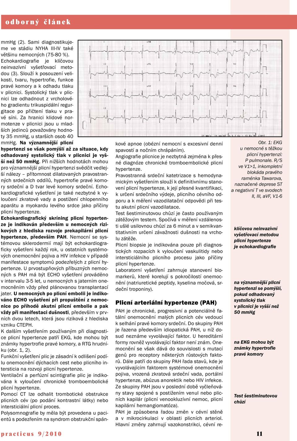 Systolický tlak v plicnici lze odhadnout z vrcholového gradientu trikuspidální regurgitace po přičtení tlaku v pravé síni.