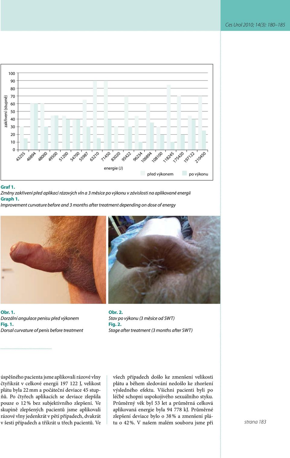 Improvement curvature before and 3 months after treatment depending on dose of energy Obr. 1. Dorzální angulace penisu před výkonem Fig. 1. Dorsal curvature of penis before treatment Obr. 2.