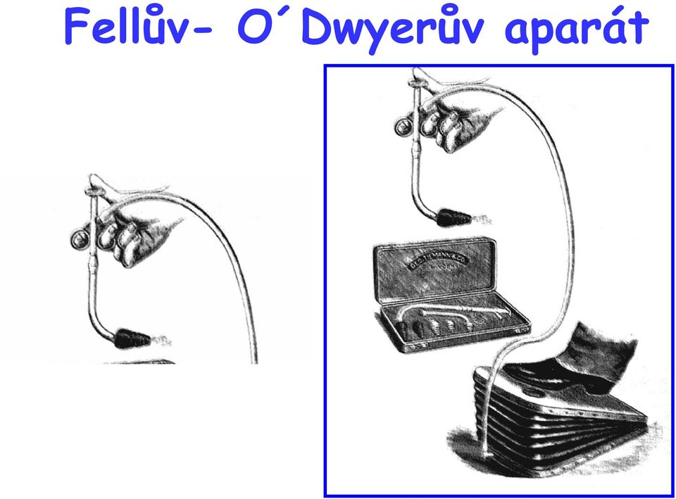 aparát