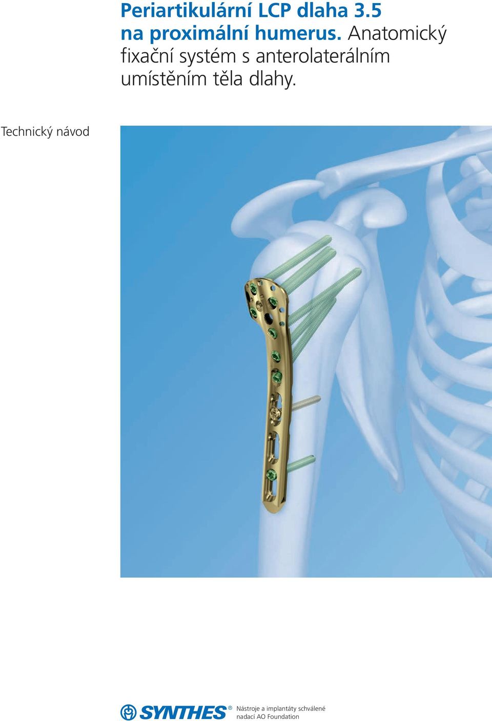 Anatomický fixační systém s anterolaterálním