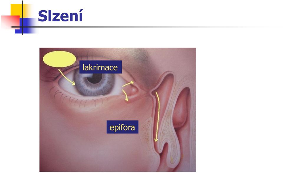 epifora