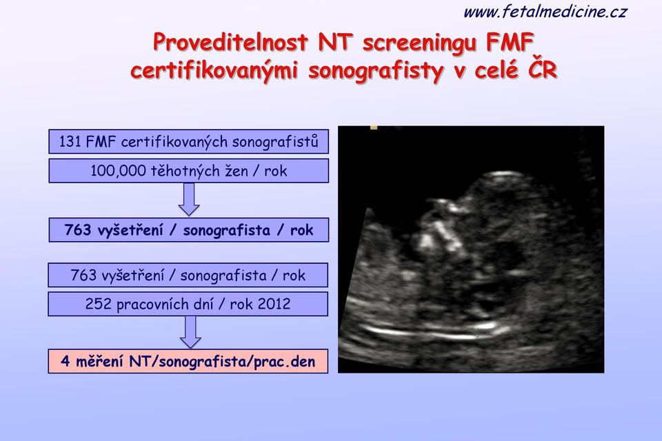 / rok 763 vyšetření / sonografista / rok 763 vyšetření /