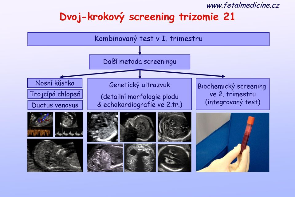 Ductus venosus Genetický ultrazvuk (detailní morfologie plodu &