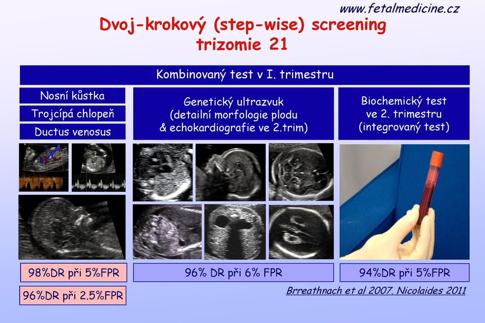 morfologie plodu & echokardiografie ve 2.trim) Biochemický test ve 2.