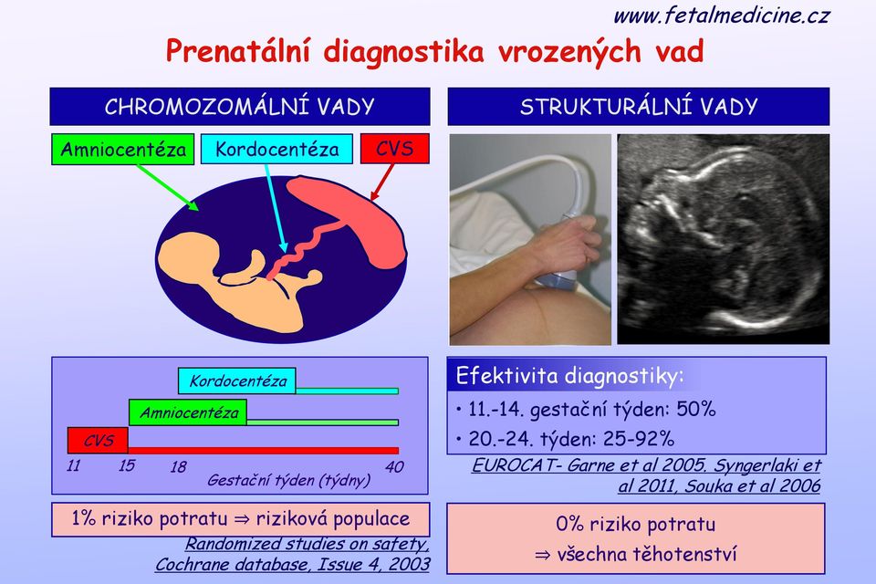 studies on safety, Cochrane database, Issue 4, 2003 Efektivita diagnostiky: 11.-14. gestační týden: 50% 20.-24.