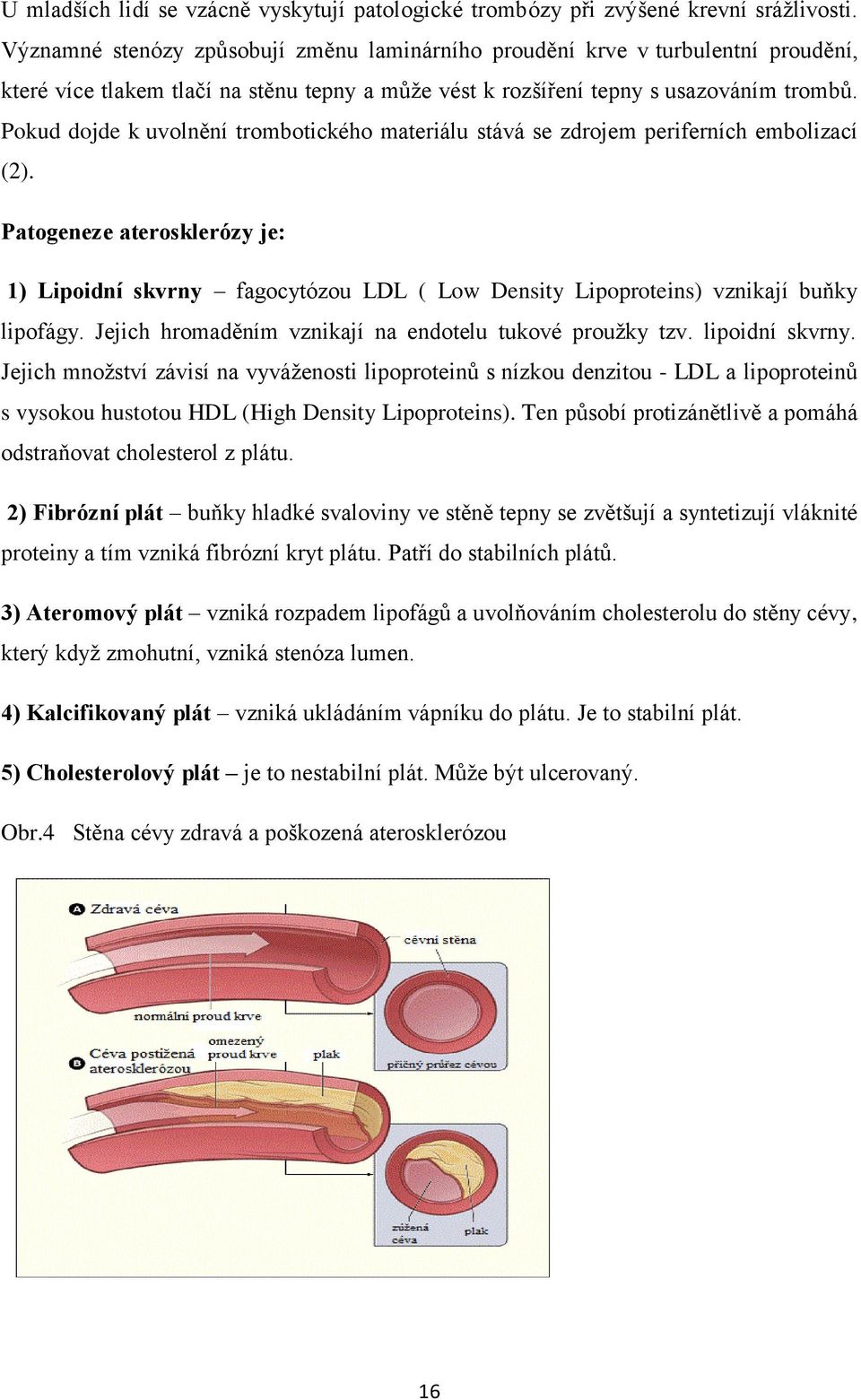 Pokud dojde k uvolnění trombotického materiálu stává se zdrojem periferních embolizací (2).