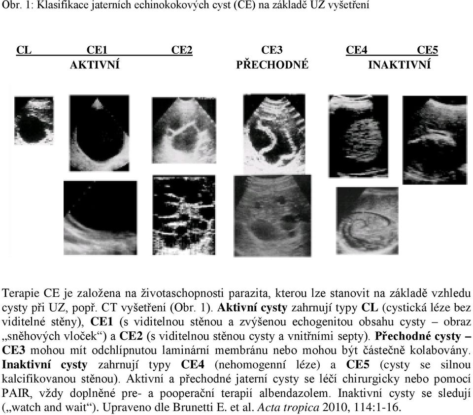 Aktivní cysty zahrnují typy CL (cystická léze bez viditelné stěny), CE1 (s viditelnou stěnou a zvýšenou echogenitou obsahu cysty obraz sněhových vloček ) a CE2 (s viditelnou stěnou cysty a vnitřními