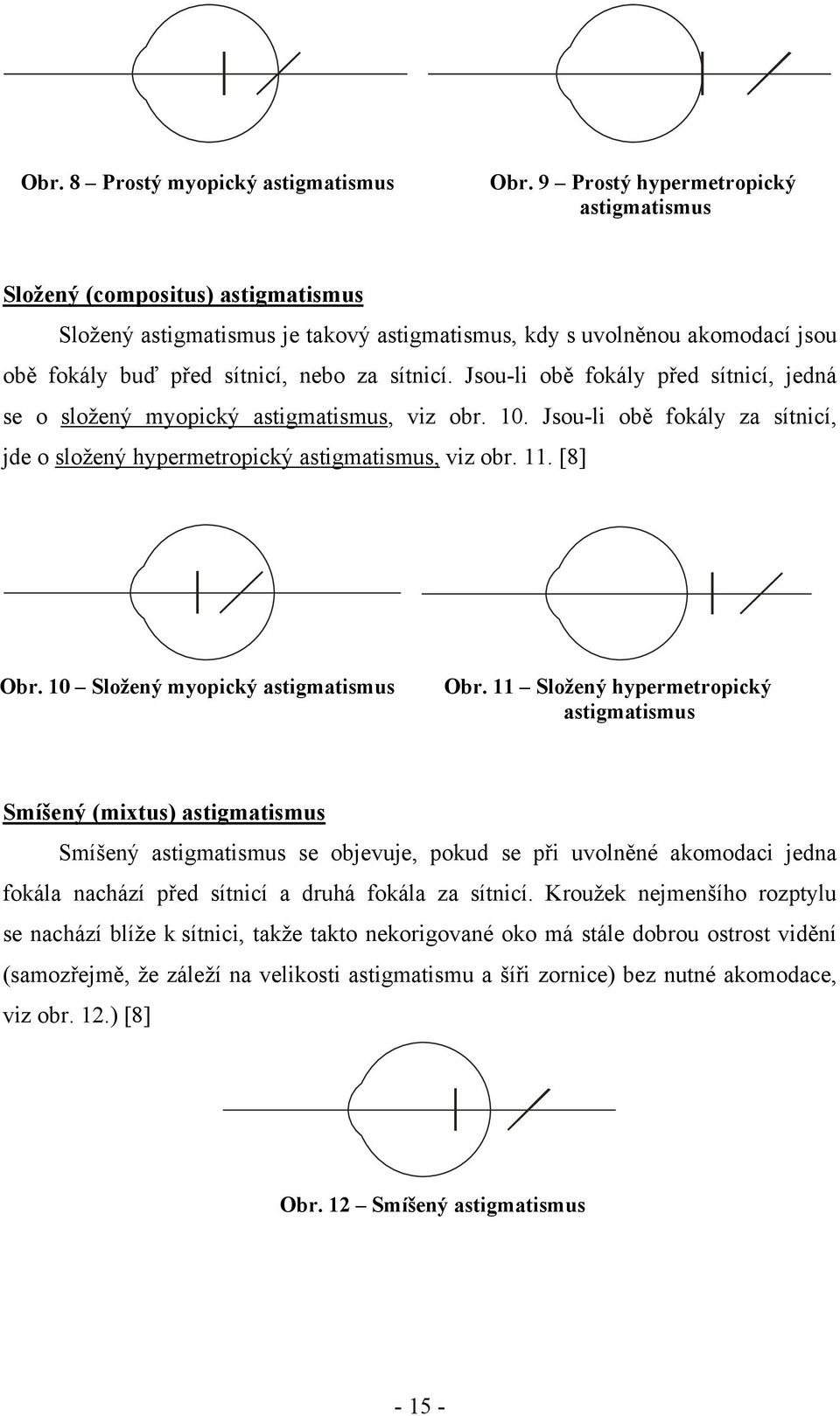 Jsou-li obě fokály před sítnicí, jedná se o složený myopický astigmatismus, viz obr. 10. Jsou-li obě fokály za sítnicí, jde o složený hypermetropický astigmatismus, viz obr. 11. [8] Obr.