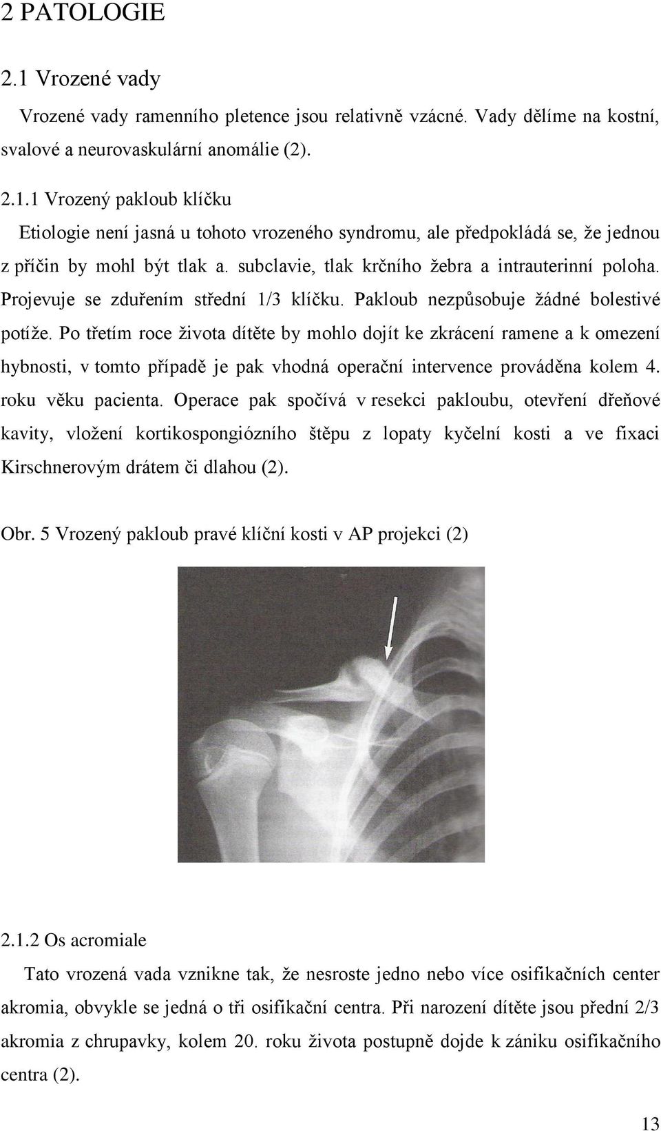 Po třetím roce života dítěte by mohlo dojít ke zkrácení ramene a k omezení hybnosti, v tomto případě je pak vhodná operační intervence prováděna kolem 4. roku věku pacienta.