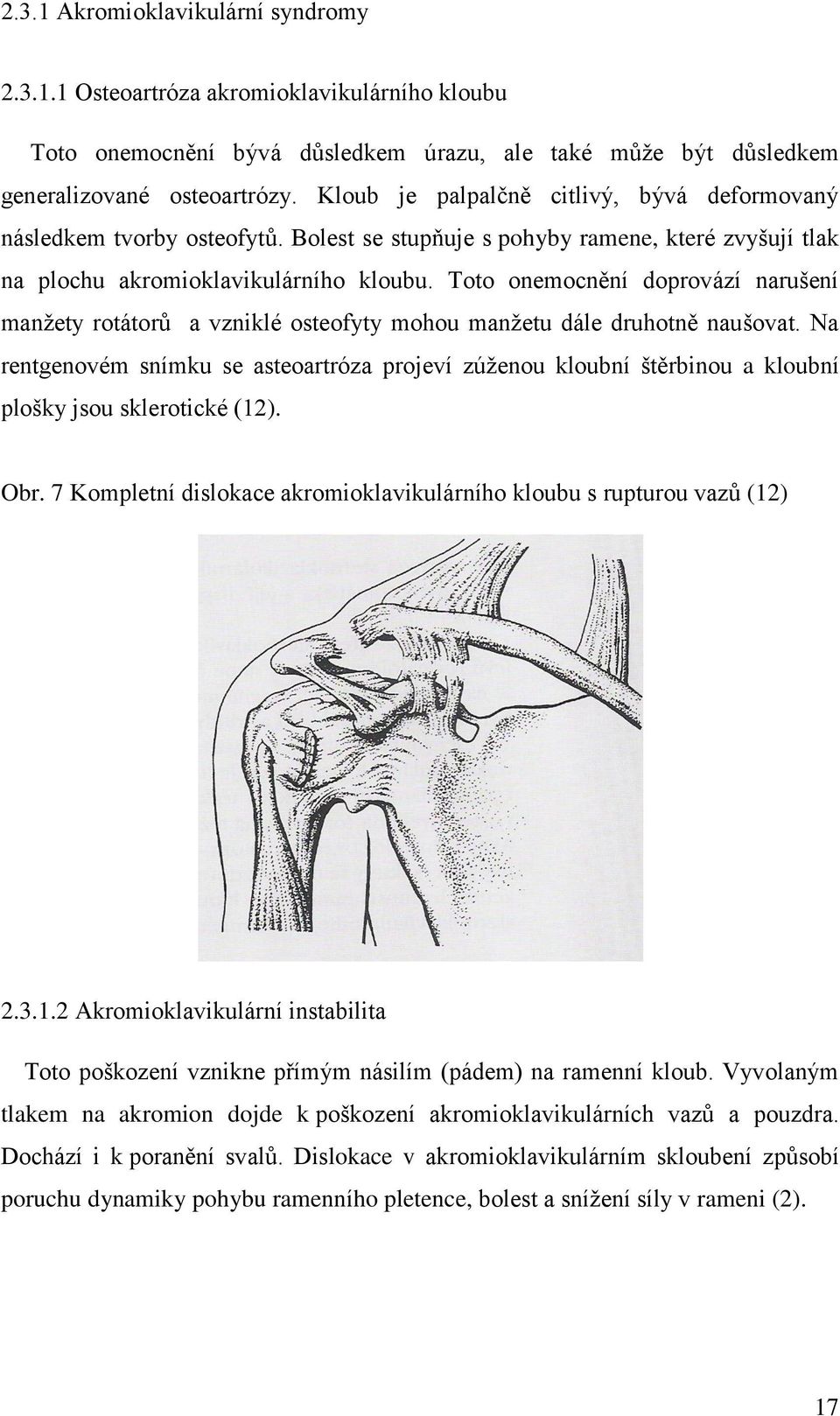 Toto onemocnění doprovází narušení manžety rotátorů a vzniklé osteofyty mohou manžetu dále druhotně naušovat.