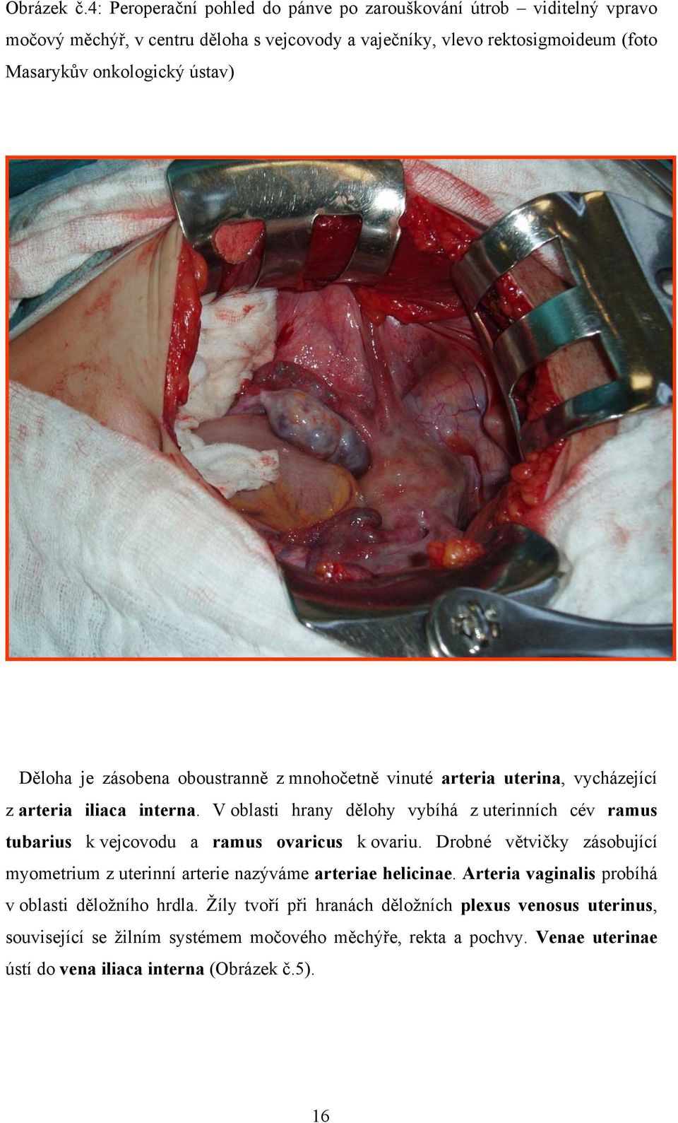 ústav) Děloha je zásobena oboustranně z mnohočetně vinuté arteria uterina, vycházející z arteria iliaca interna.