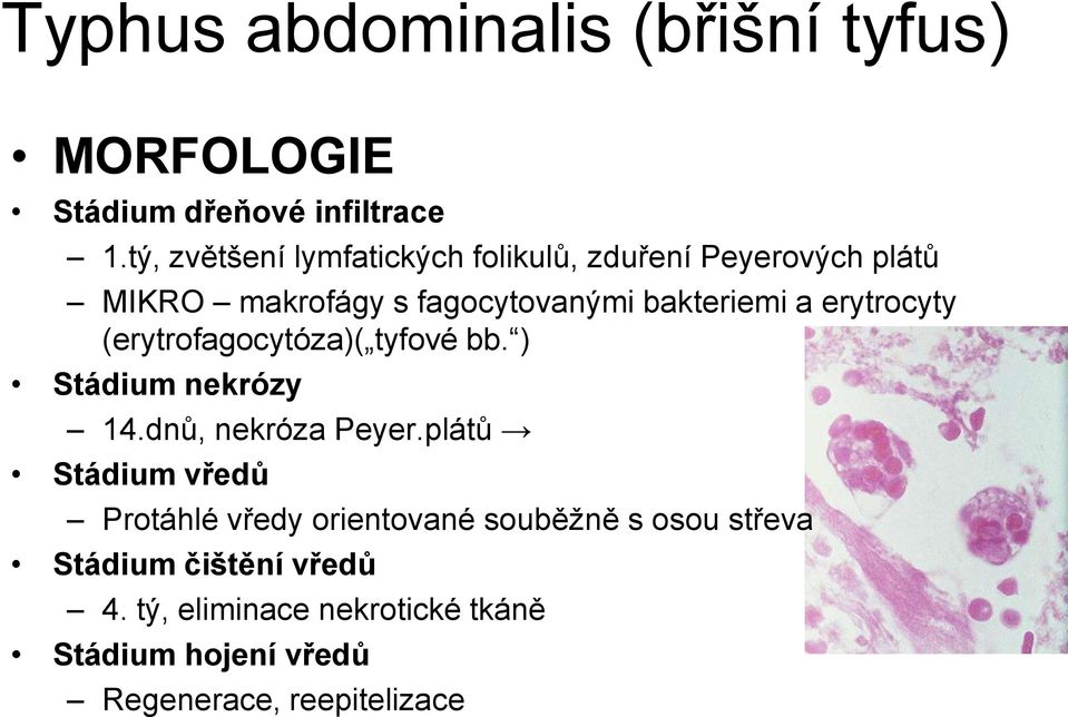 erytrocyty (erytrofagocytóza)( tyfové bb. ) Stádium nekrózy 14.dnů, nekróza Peyer.