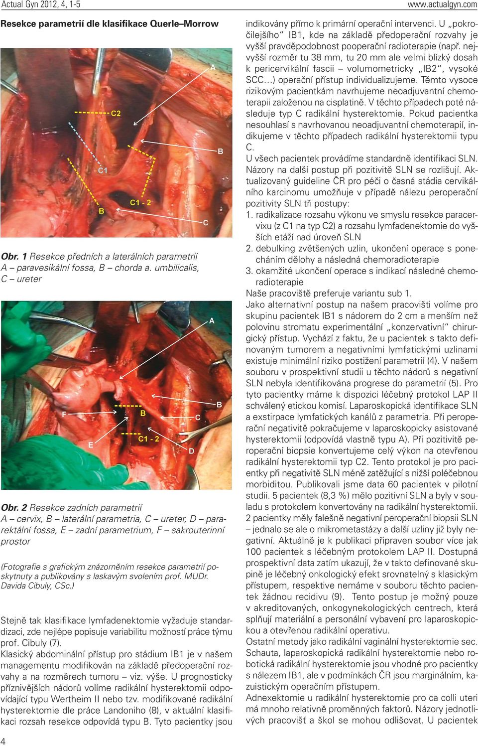 poskytnuty a publikovány s laskavým svolením prof. MUDr. Davida Cibuly, CSc.) Stejně tak klasifikace lymfadenektomie vyžaduje standardizaci, zde nejlépe popisuje variabilitu možností práce týmu prof.