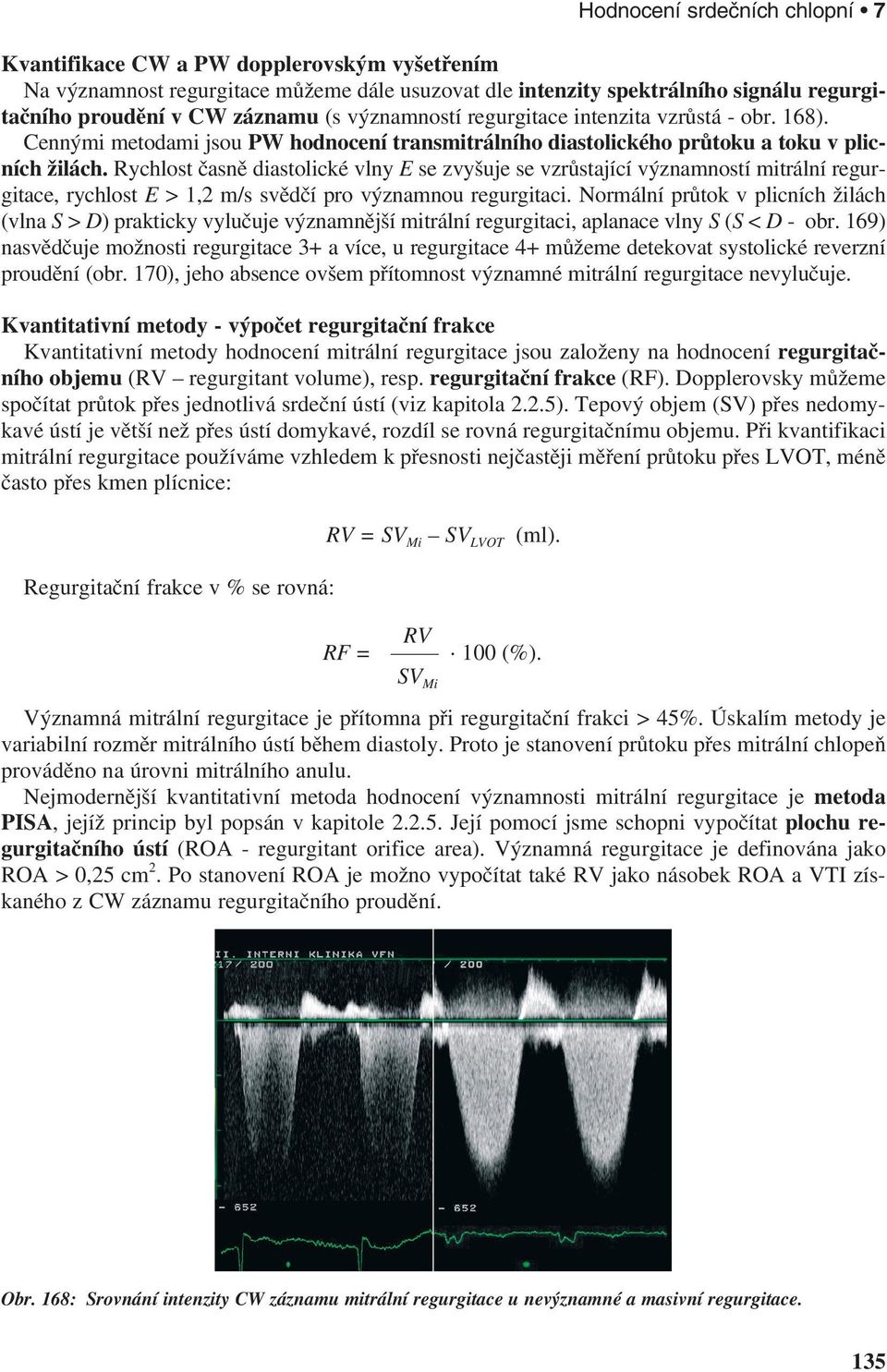 Rychlost časně diastolické vlny E se zvyšuje se vzrůstající významností mitrální regurgitace, rychlost E > 1,2 m/s svědčí pro významnou regurgitaci.