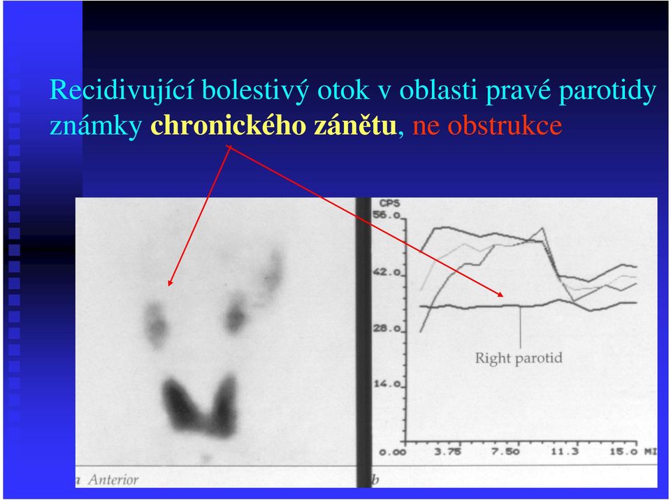 parotidy známky