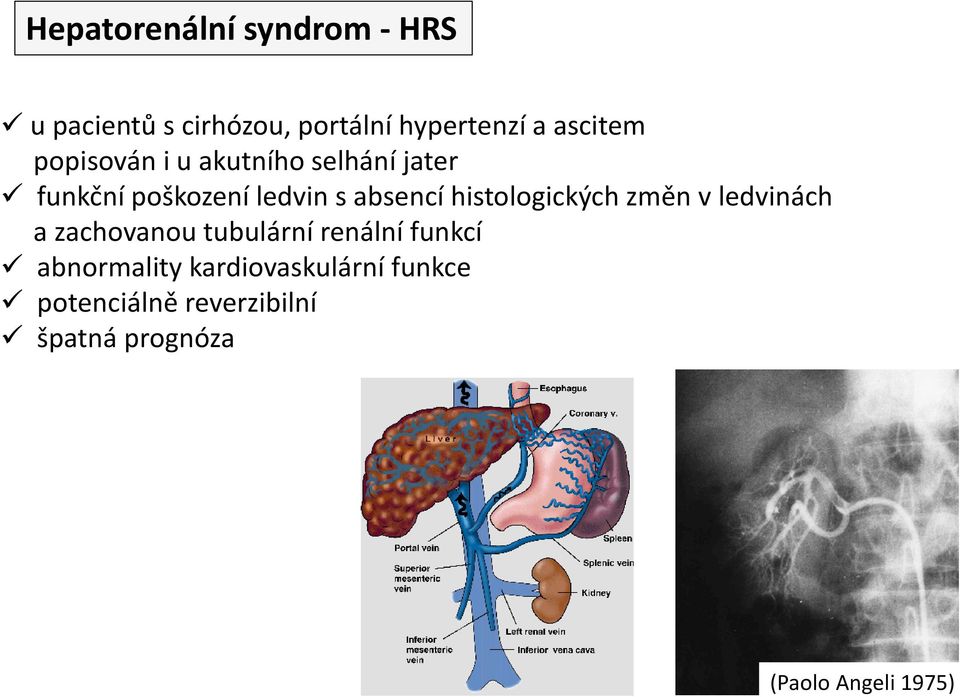 histologických změn v ledvinách a zachovanou tubulární renální funkcí