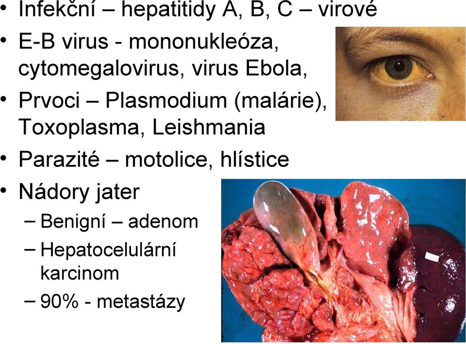 Plasmodium (malárie), Toxoplasma, Leishmania Parazité