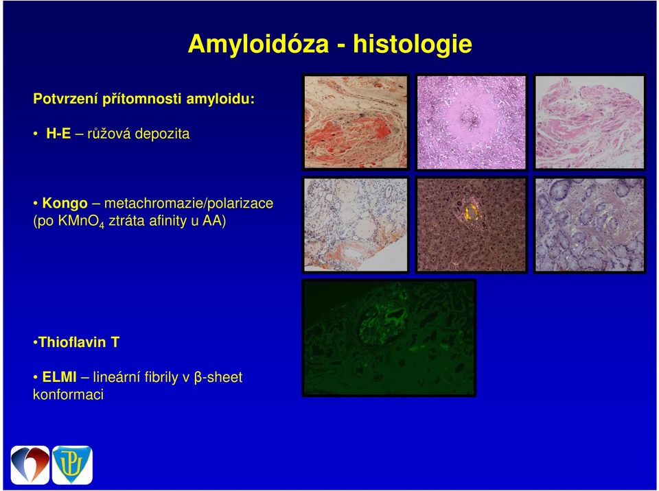 metachromazie/polarizace (po KMnO 4 ztráta