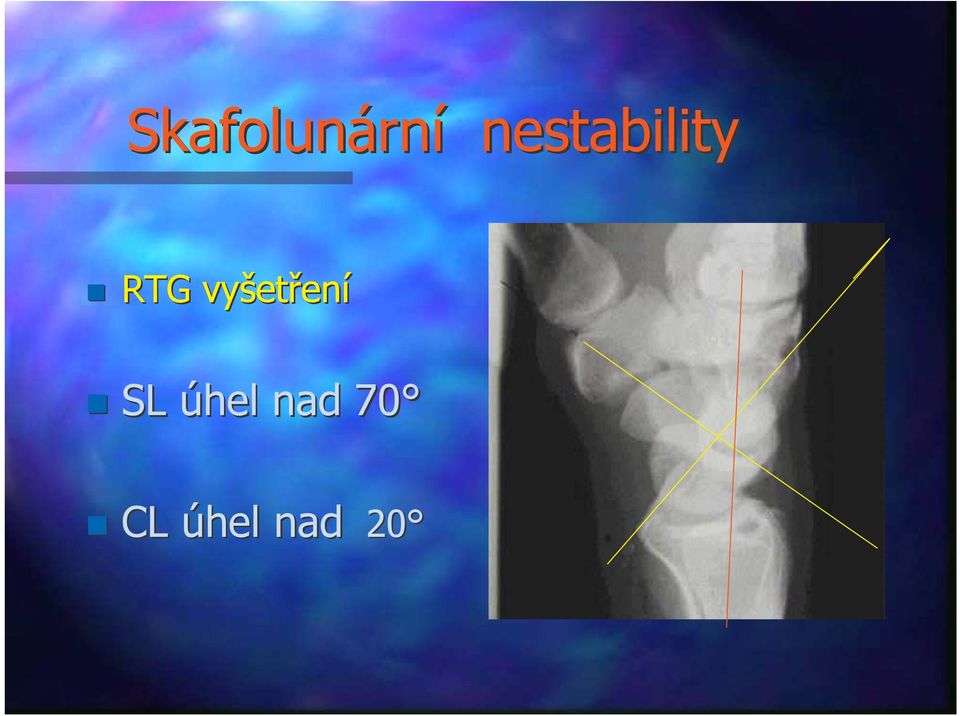 vyšetření SL