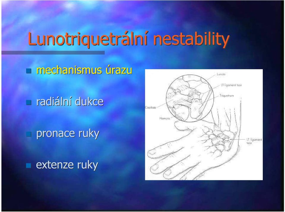 mechanismus úrazu