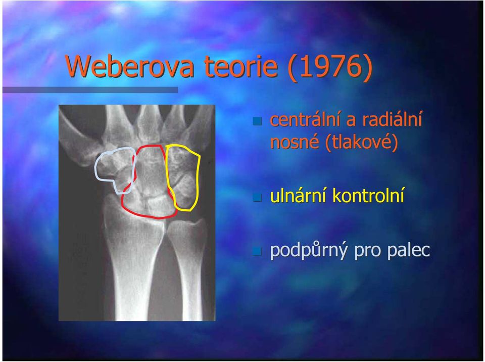 nosné (tlakové) ulnární