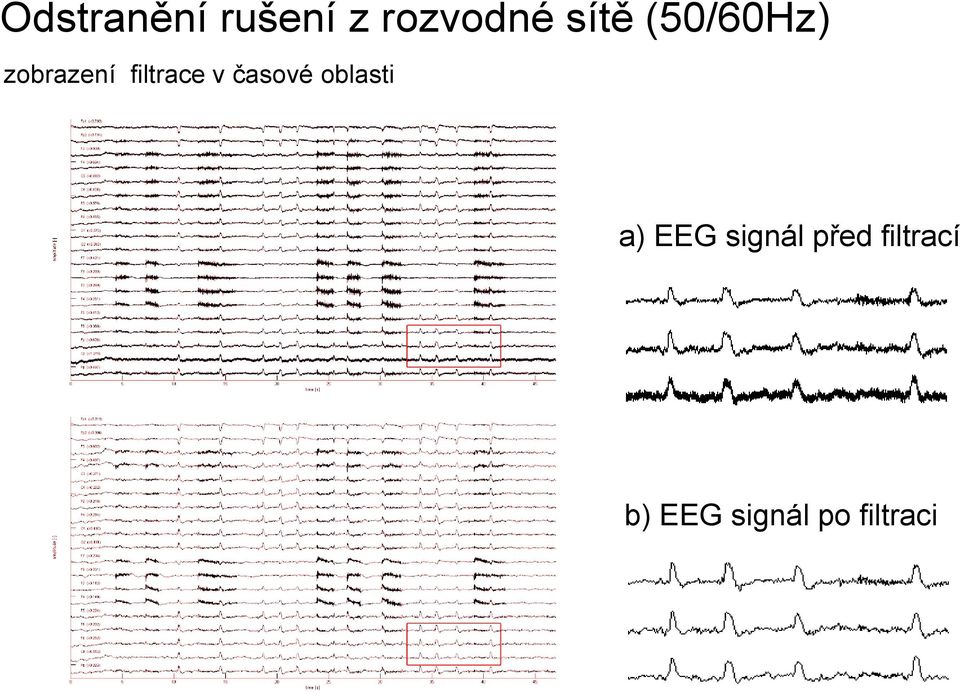 časové oblasti a) EEG signál před