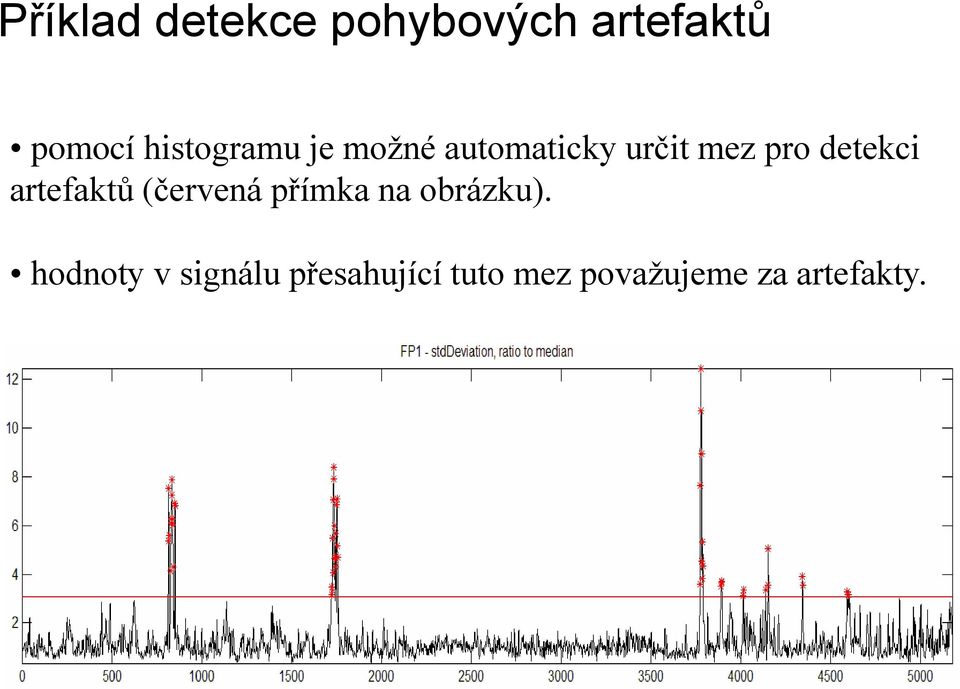 detekci artefaktů (červená přímka na obrázku).