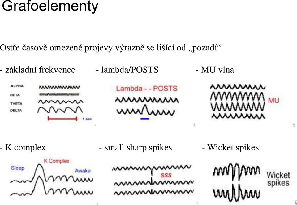 základní frekvence - lambda/posts - MU