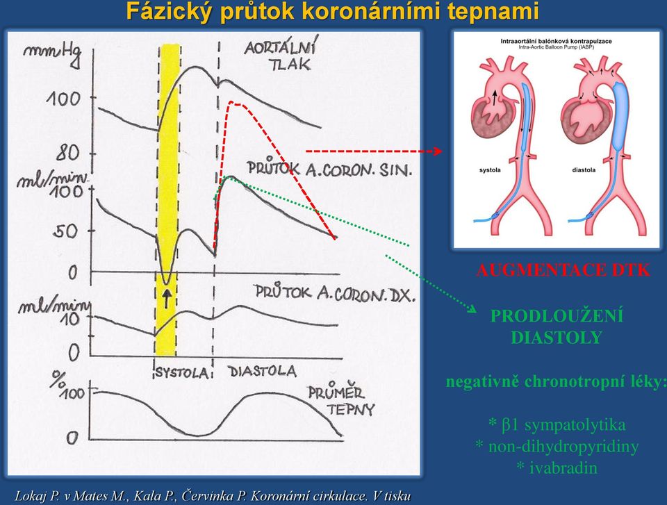 V tisku AUGMENTACE DTK PRODLOUŽENÍ DIASTOLY negativně