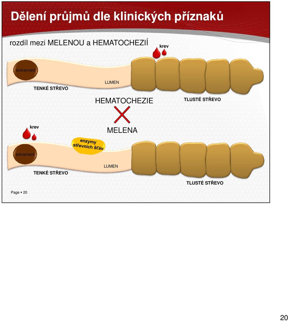 STŘEVO LUMEN HEMATOCHEZIE TLUSTÉ STŘEVO krev