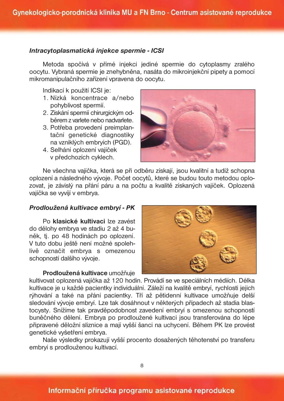 Získání spermií chirurgickým odběrem z varlete nebo nadvarlete. 3. Potřeba provedení preimplantační genetické diagnostiky na vzniklých embryích (PGD). 4.