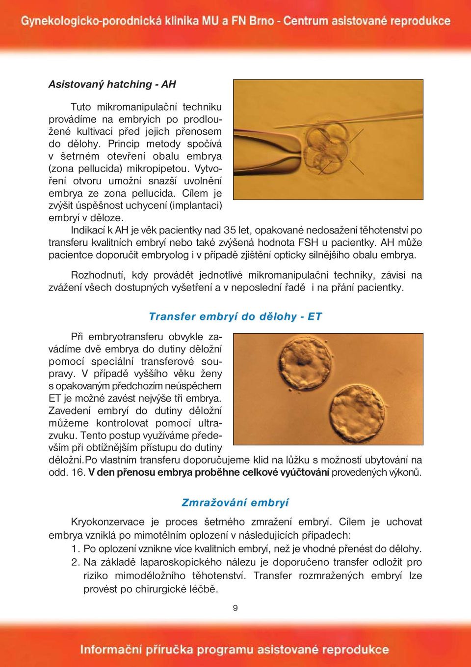 Cílem je zvýšit úspěšnost uchycení (implantaci) embryí v děloze.