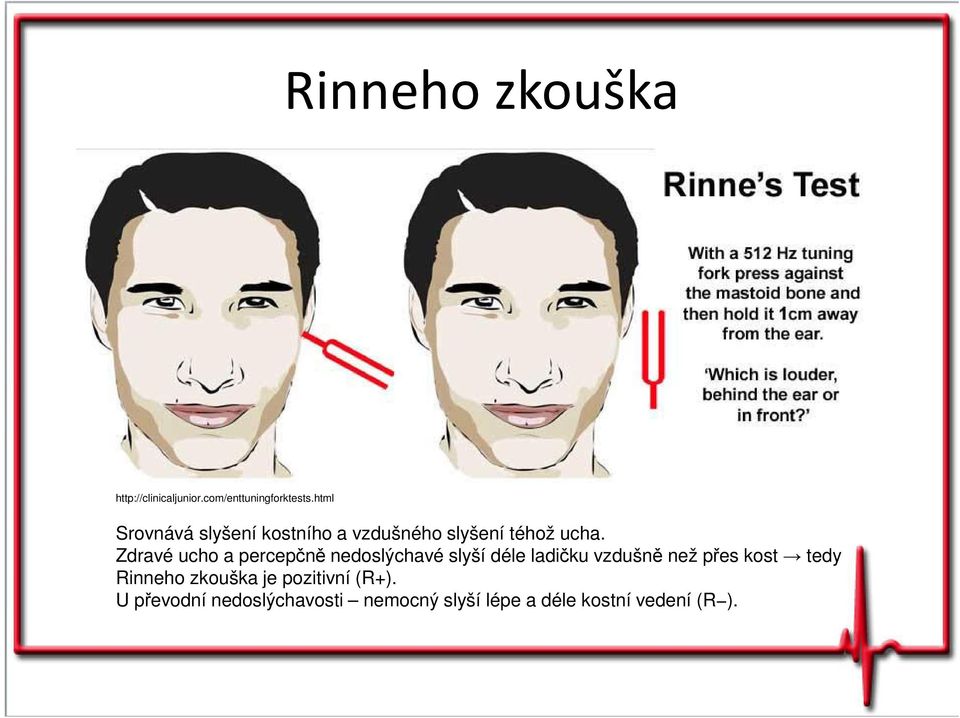 Zdravé ucho a percepčně nedoslýchavé slyší déle ladičku vzdušně než přes kost