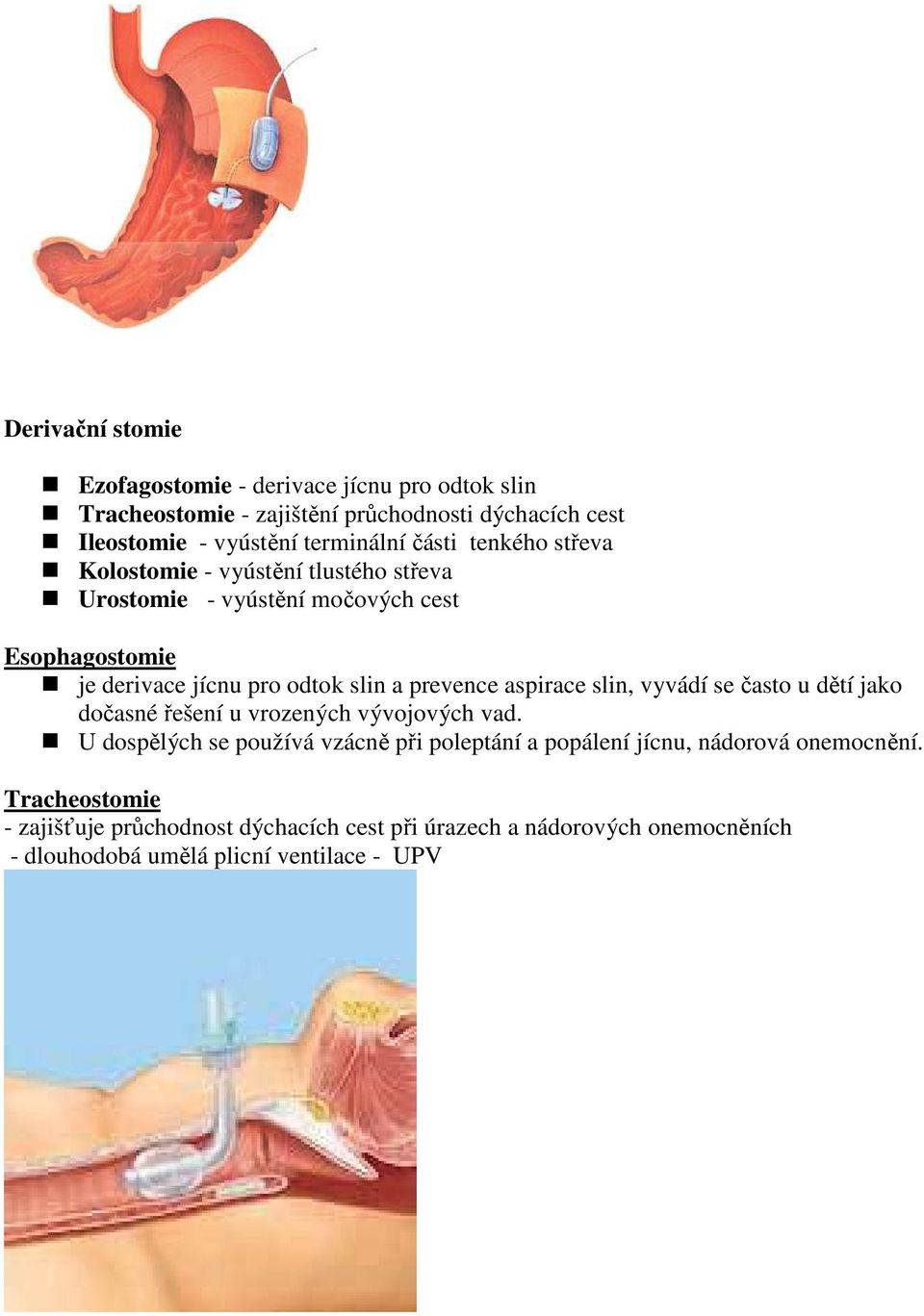 prevence aspirace slin, vyvádí se často u dětí jako dočasné řešení u vrozených vývojových vad.