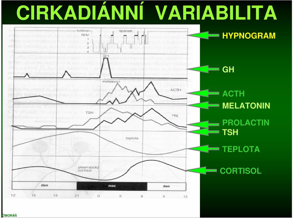 HYPNOGRAM GH ACTH