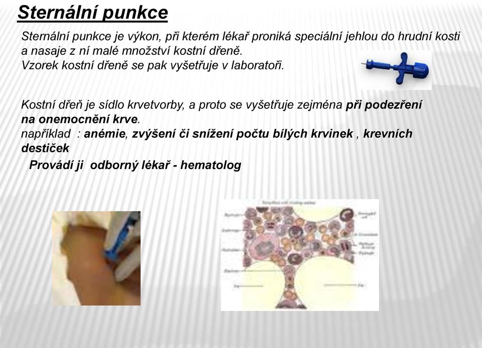 Kostní dřeň je sídlo krvetvorby, a proto se vyšetřuje zejména při podezření na onemocnění krve.