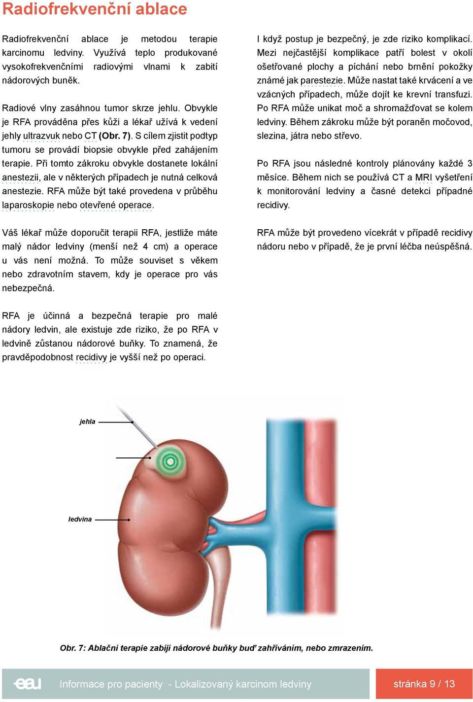 S cílem zjistit podtyp tumoru se provádí biopsie obvykle před zahájením terapie. Při tomto zákroku obvykle dostanete lokální anestezii, ale v některých případech je nutná celková anestezie.