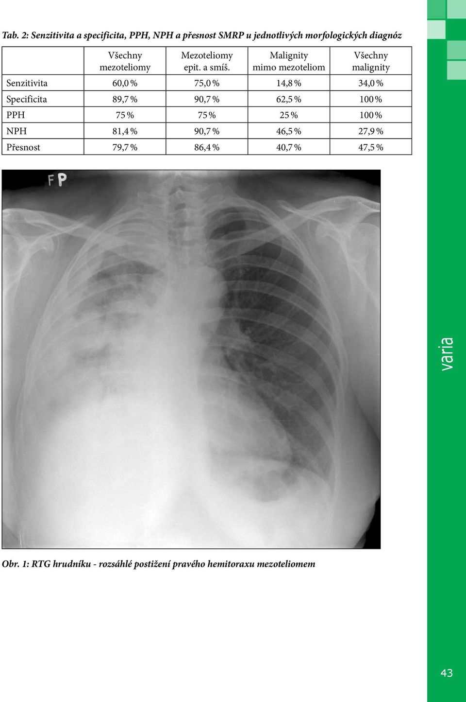 Malignity mimo mezoteliom Všechny malignity Senzitivita 60,0 % 75,0 % 4,8 % 34,0 % Specificita 89,7 % 90,7